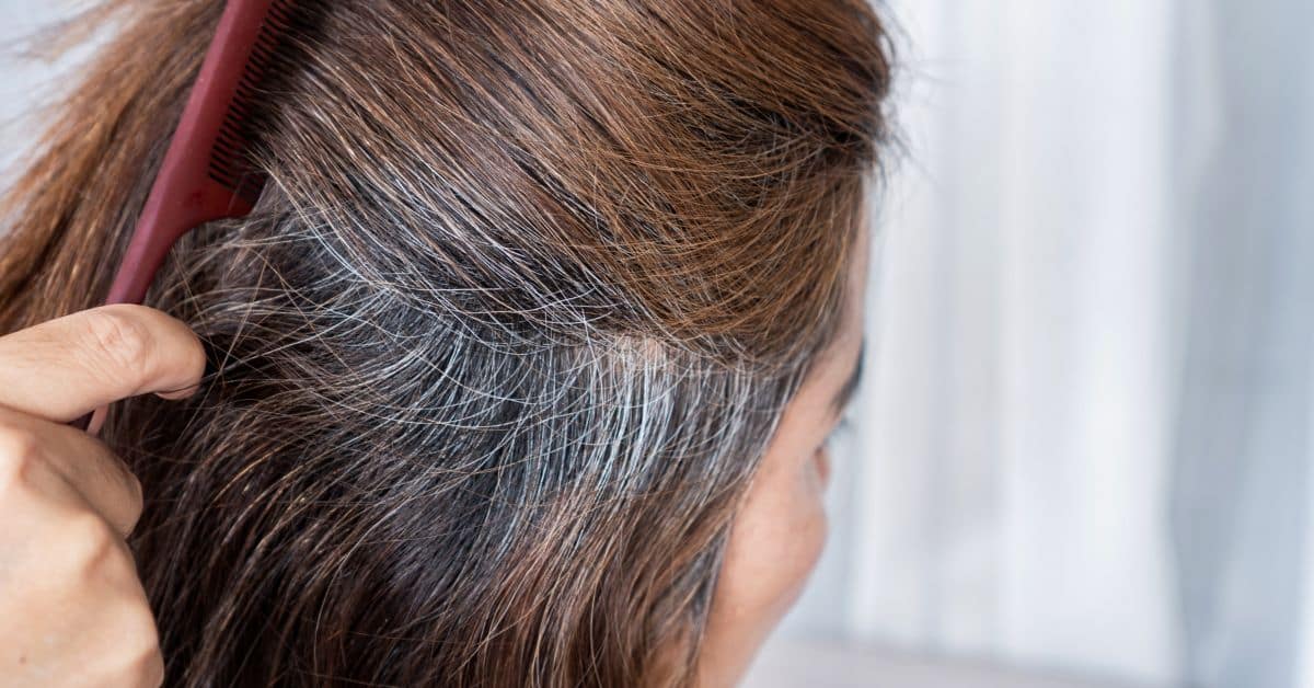 Pelo blanco o canoso en la mujer jóven