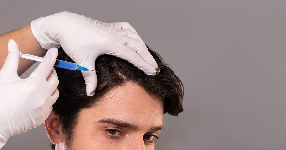 Mesoterapia capilar antes y después: resultados esperables