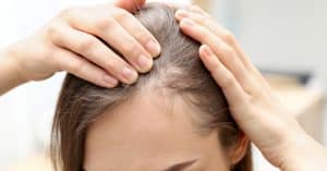 Tratamientos contra la alopecia y fertilidad